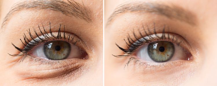 verdediging mineraal bijkeuken Donkere kringen onder je ogen, oorzaken en tips | Beauty Rubriek