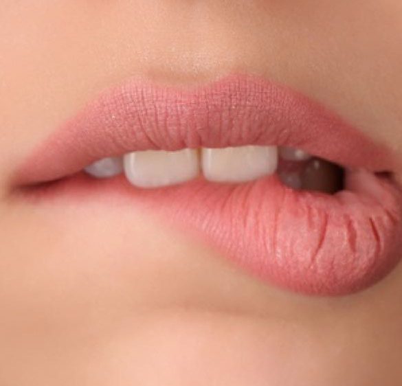 droge en gebarsten lippen