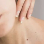 Vrouwelijke nek met moedervlek en hand.