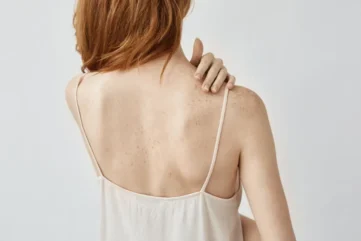 vrouw met hemdje, blote rug en hand op schouder