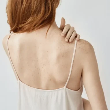 vrouw met hemdje, blote rug en hand op schouder